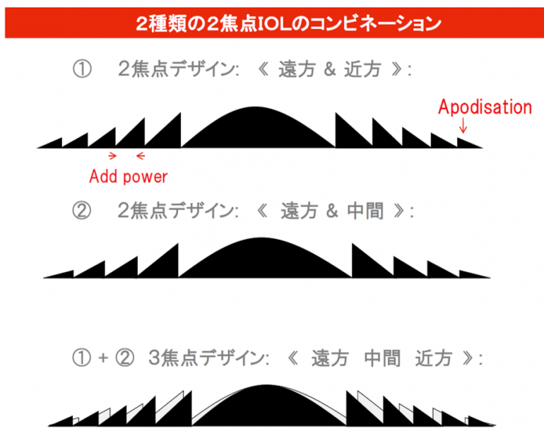 10.2	遠近の２焦点に加え、中間距離にも焦点が合います