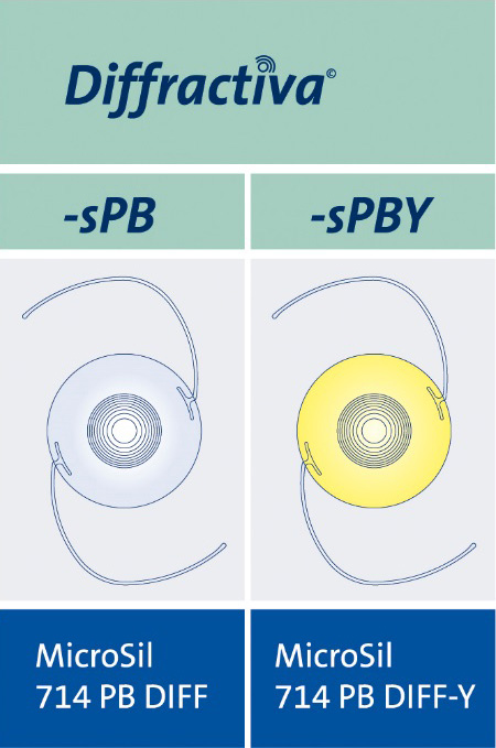 Add-on眼内レンズの種類