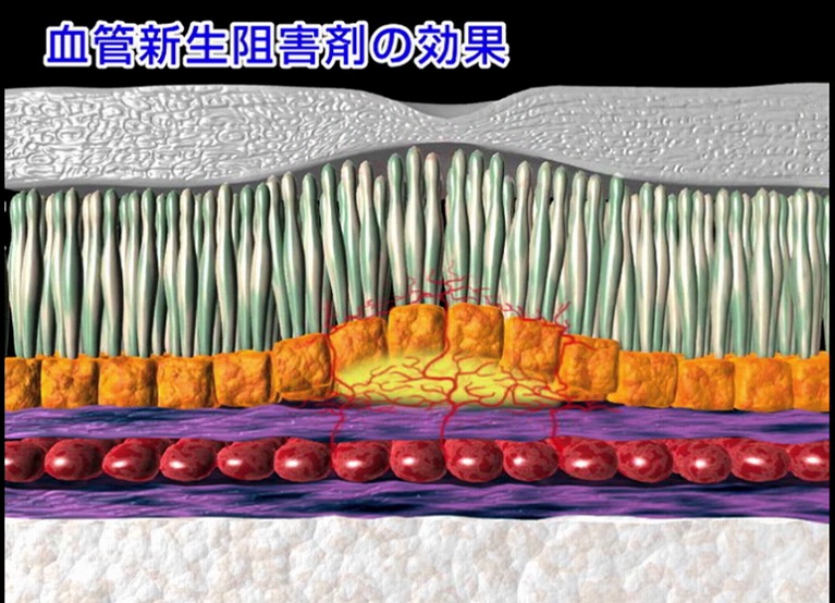 抗VEGF療法