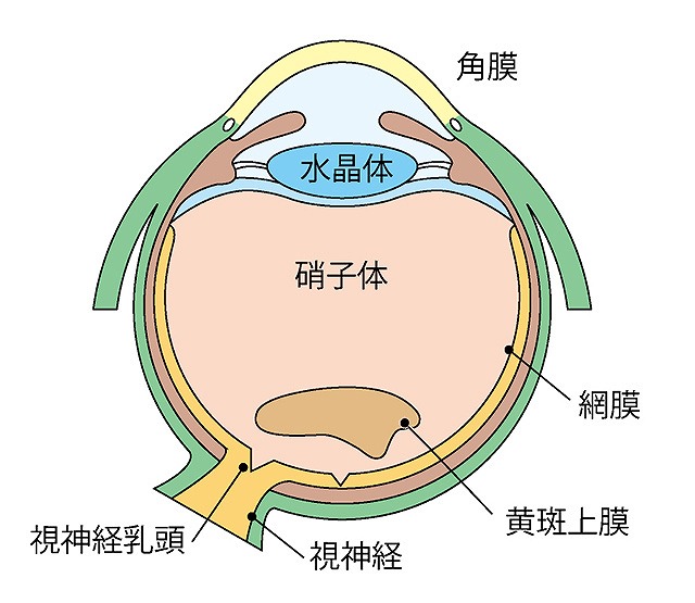 黄斑上膜