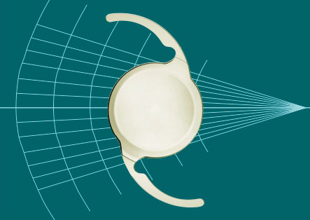 回折構造を用いない屈折型光学設計（Purely Refractive Design）