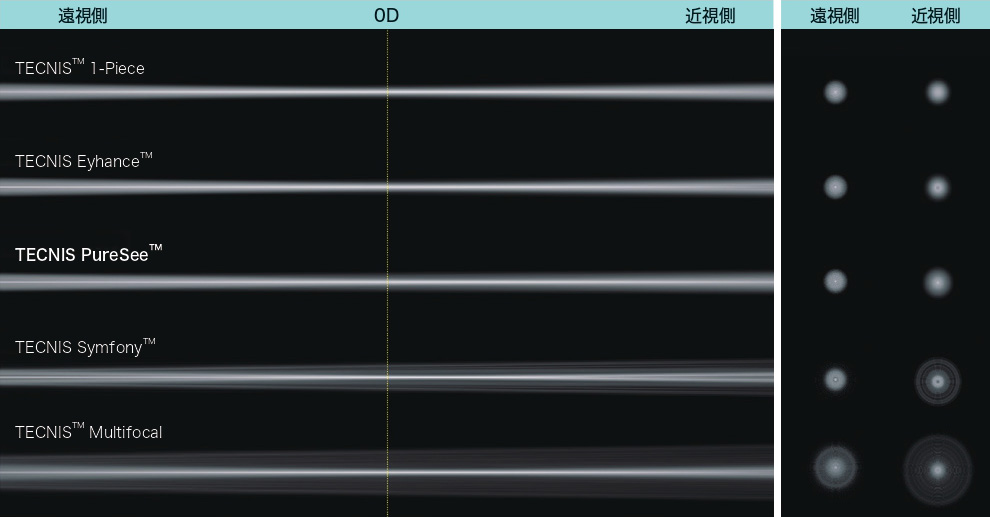 残余屈折が生じた場合でも単焦点眼内レンズに近い光視症特性に配慮した設計