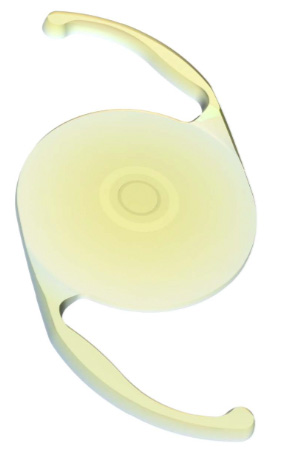 クラレオンビビティ（Clareon® Vivity®）