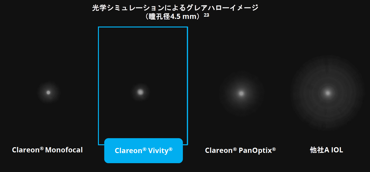 Clareon® Vivity®におけるグレアやハローといった光学的な現象は、従来の多焦点眼内レンズと比較して少なく、単焦点レンズと同程度のレベルに抑えられることが示されています。