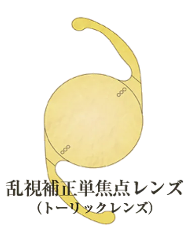 乱視矯正について